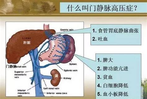 脾臟功能不好|認識脾臟：脾臟的位置及功能